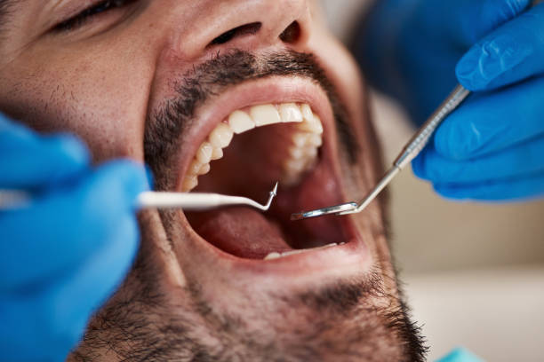 Best Pediatric Emergency Dentist in Kings Park West, VA